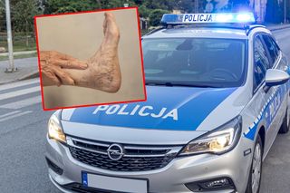 „Obciąłem mamie nogę”. Szokujący telefon na 112! Aż trudno uwierzyć w finał tej historii 